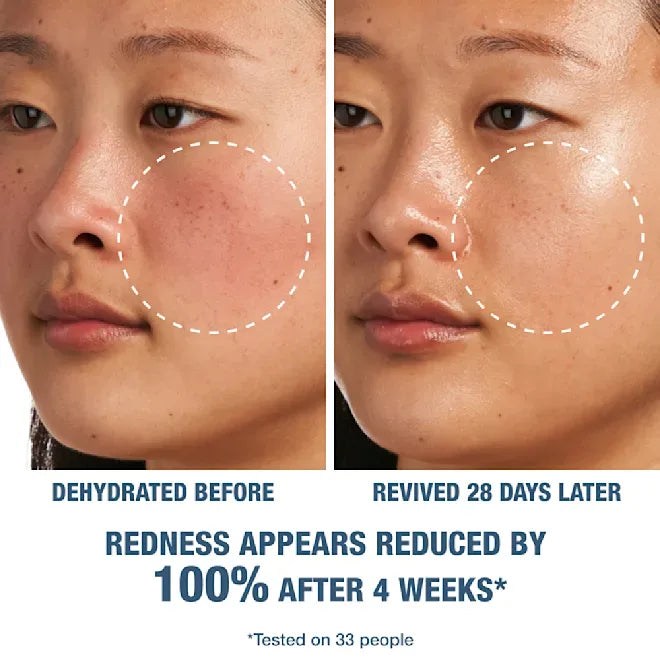 Skincare face close-up showing cream-treated cheek area