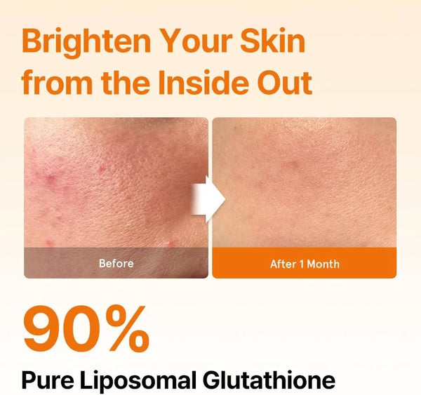 Esther Formula Liposome Glutathione Direct Ultra X Before after 