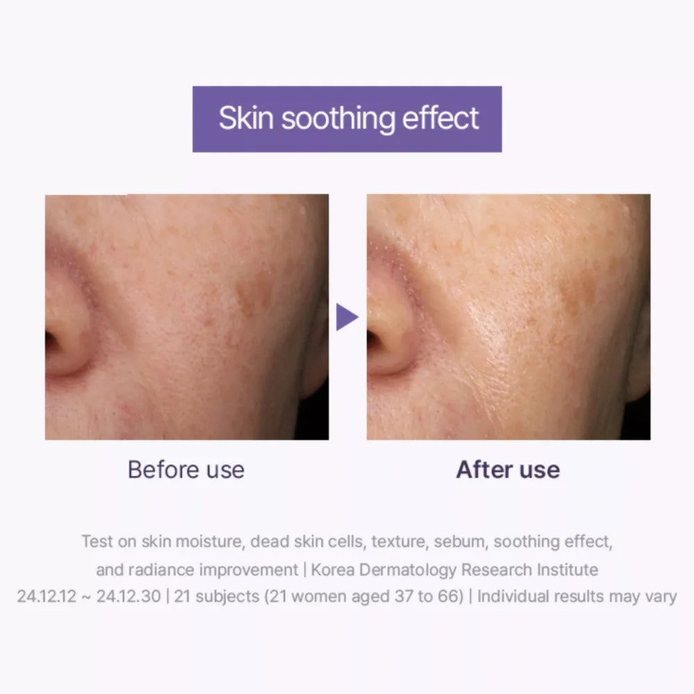 Toner skin soothing effect before and after results on face