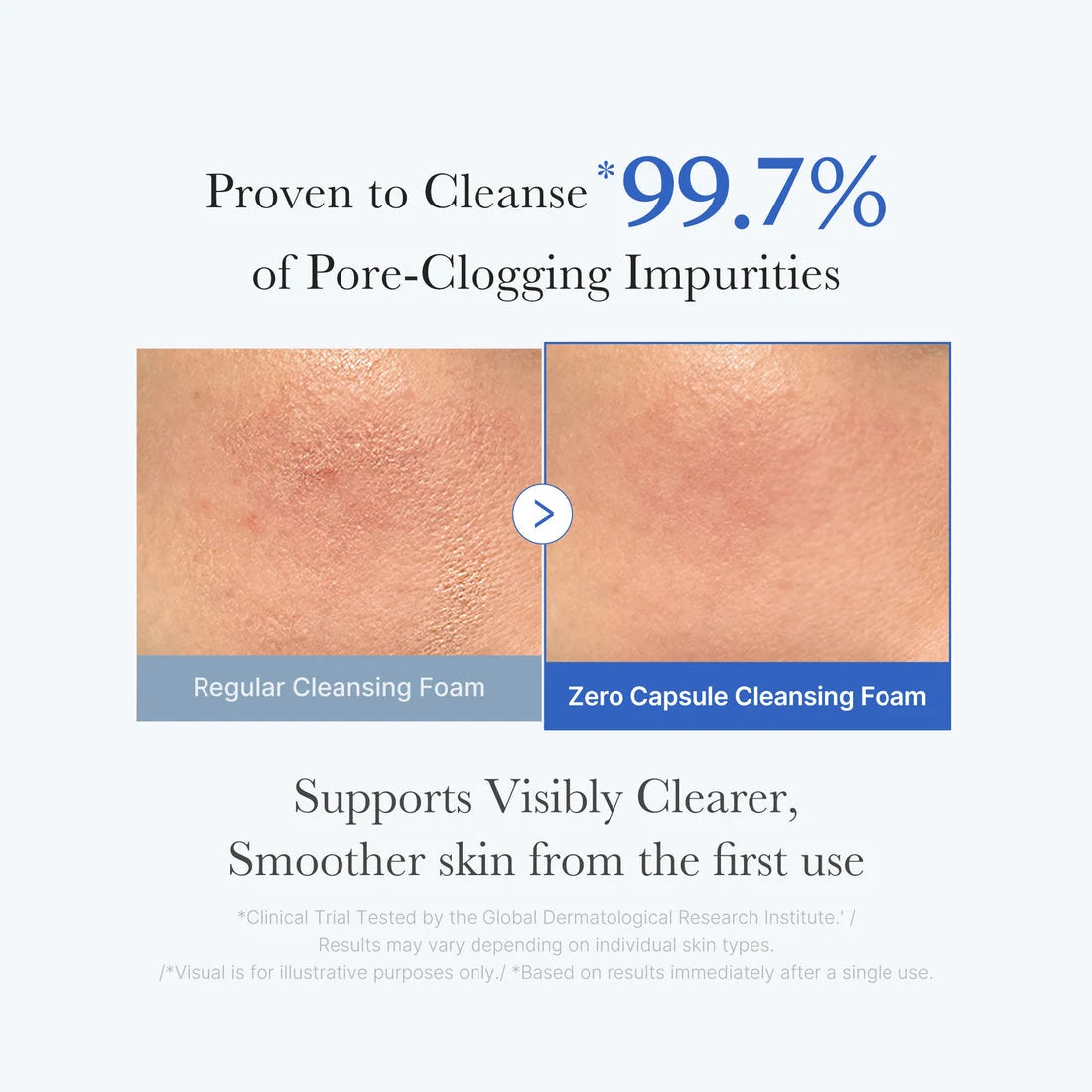 Medicube Zero Pore Capsule Cleansing Foam 120 g
