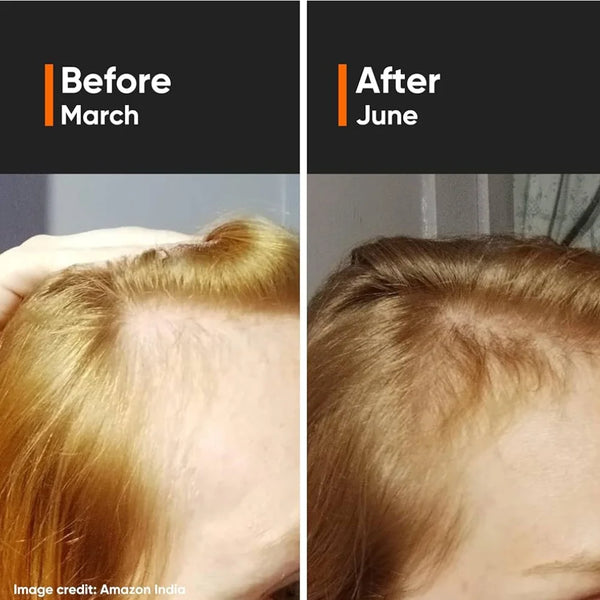 Hair growth serum results, close-up scalp and light brown hair in two panels