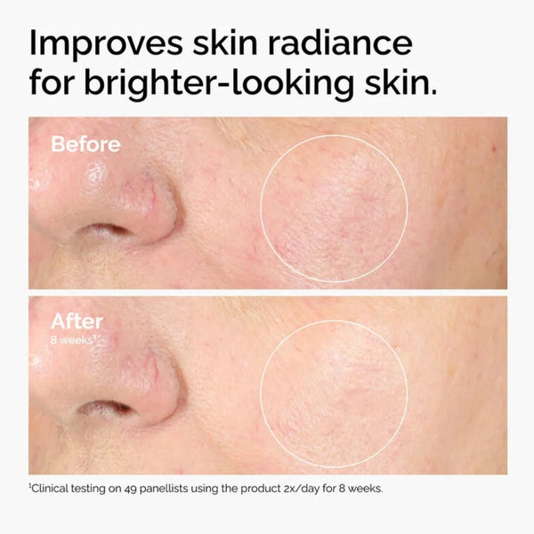 Skin close-up before-and-after showing a circled area