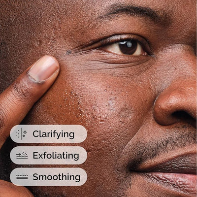 The Ordinary Salicylic Acid 2% Solution 30 Ml