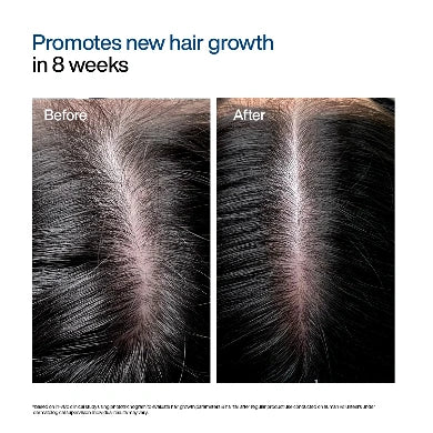 Before-and-after hair growth comparison showing a center part on dark hair, with text at the top reading 'Promotes new hair growth in 8 weeks'.